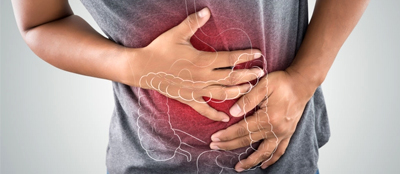 Ulcerative Colitis: Causes, Symptoms, Diagnosis & Treatment