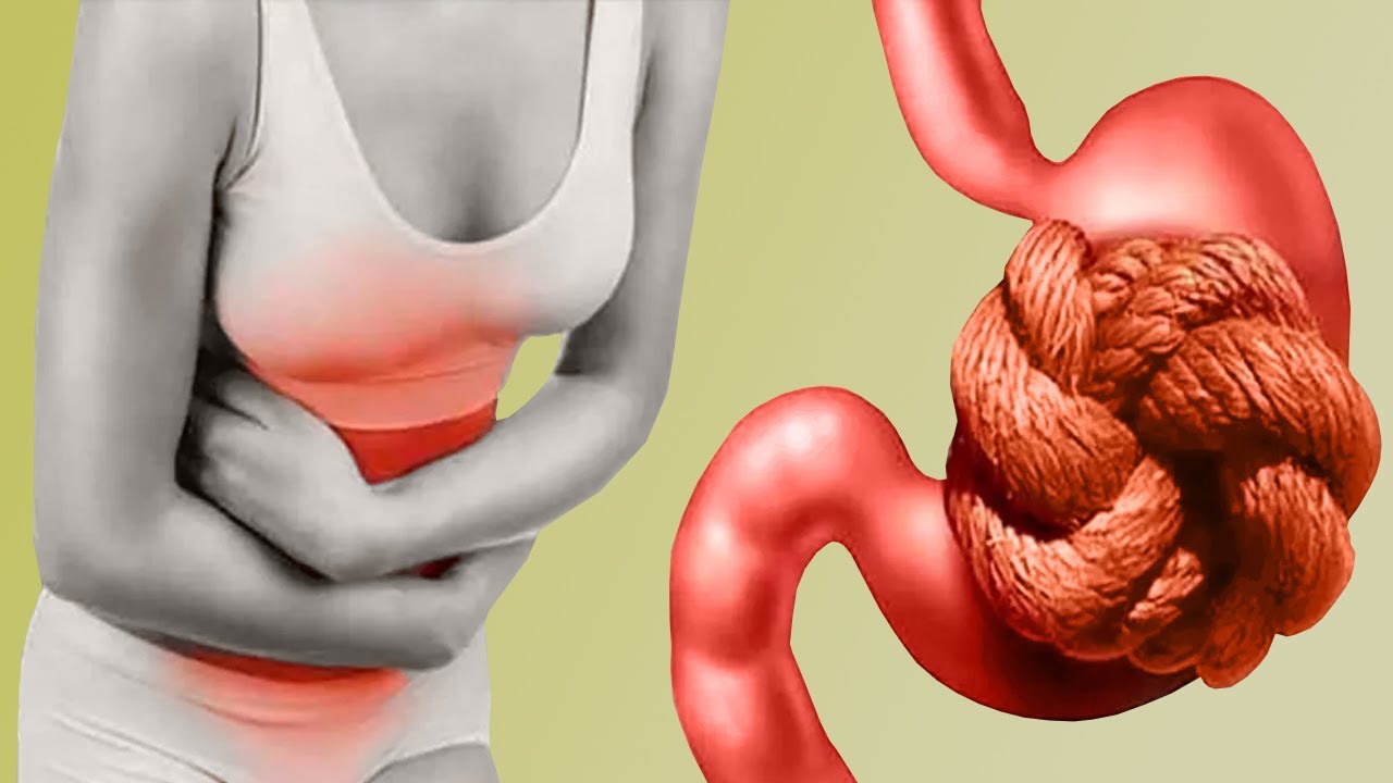 The Most Common Digestive Issues and How to Prevent them