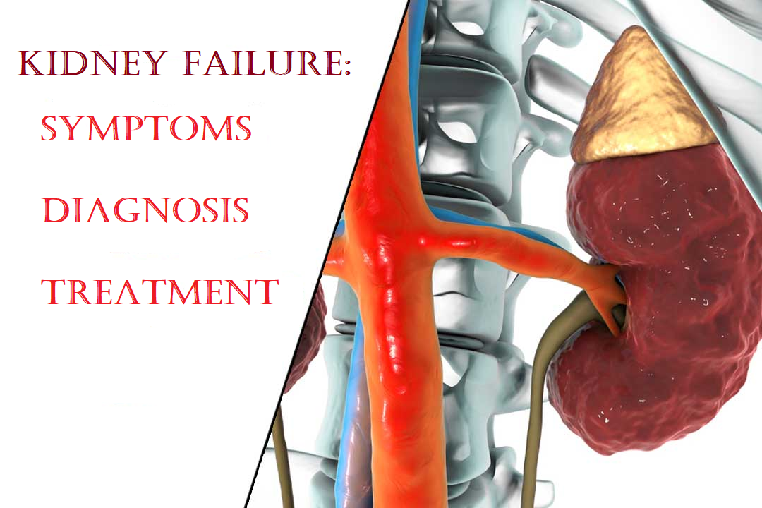 Kidney Failure: Symptoms, Diagnosis and Treatment