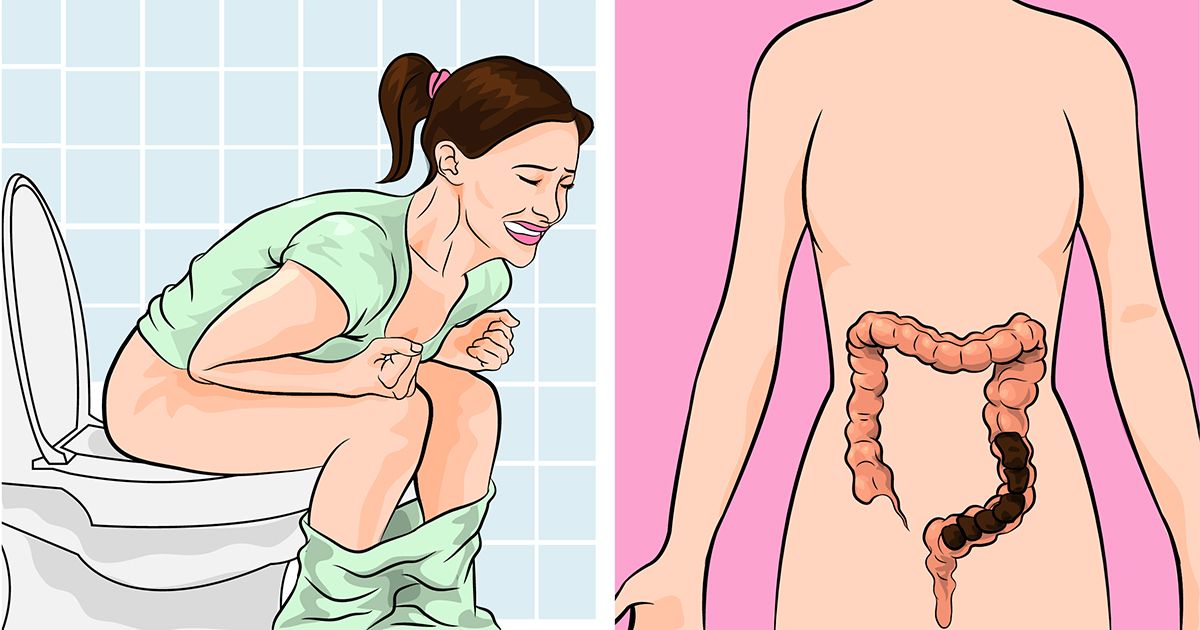 Constipation: Understanding The Symptoms, Causes, Diagnosis, And Treatment Options