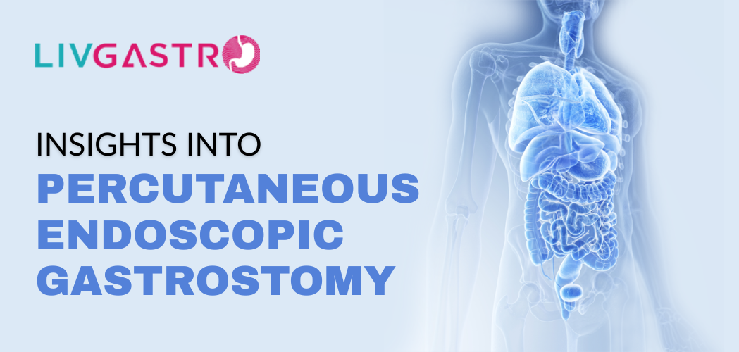 Insights into Percutaneous Endoscopic Gastrostomy (PEG) from the Best Gastroenterologists Near You