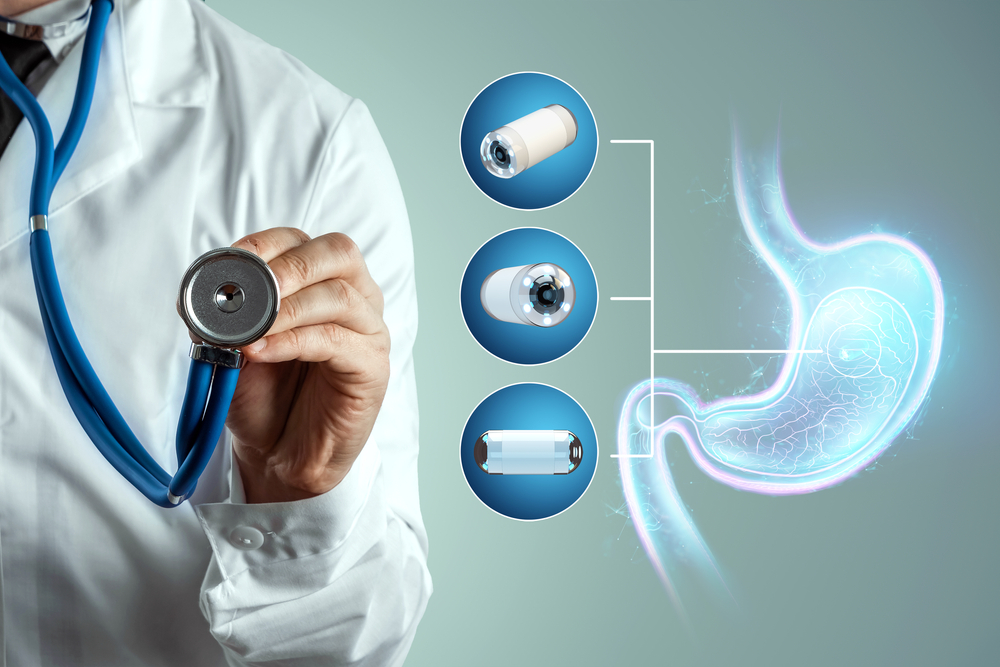Thinking About Capsule Endoscopy? Here’s What the Best Gastroenterologists Want You to Know