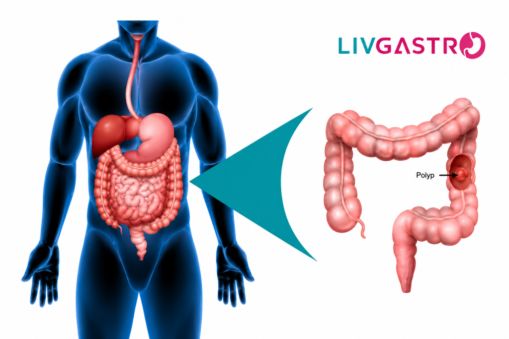 Expert gastro surgeon performing a colonoscopy procedure for safe and effective polyp removal